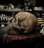 Human skull with mandible