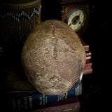 A human skull with mandible