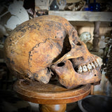Human skull with mandible