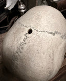 Medically prepared human skull