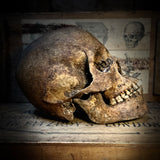 Human skull with mandible