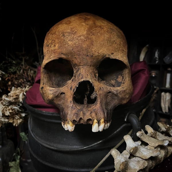 Human skull
