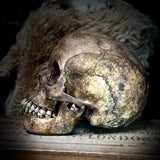 Human skull with mandible