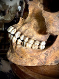 Human skull with mandible and brass teeth