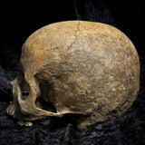 Human skull