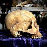 Human skull