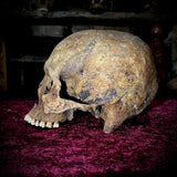 Human skull