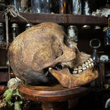 Human skull