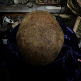 Human skull