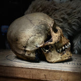 Human skull with mandible