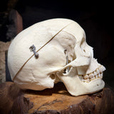 Medically prepared human skull