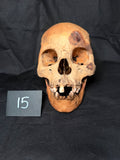 Item 15. Human skull with mandible