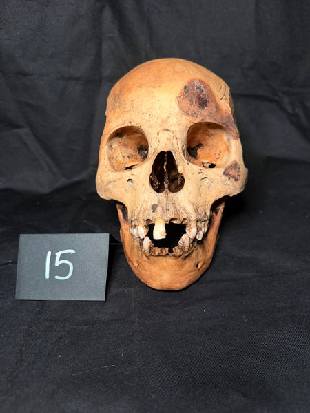 Item 15. Human skull with mandible