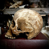Human skull
