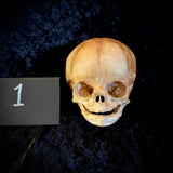 Item 1. Human fetal skull