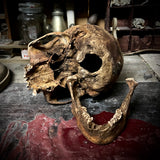 Human skull with mandible