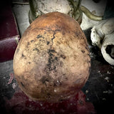 Human skull