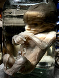Fetal specimen