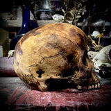 Human skull