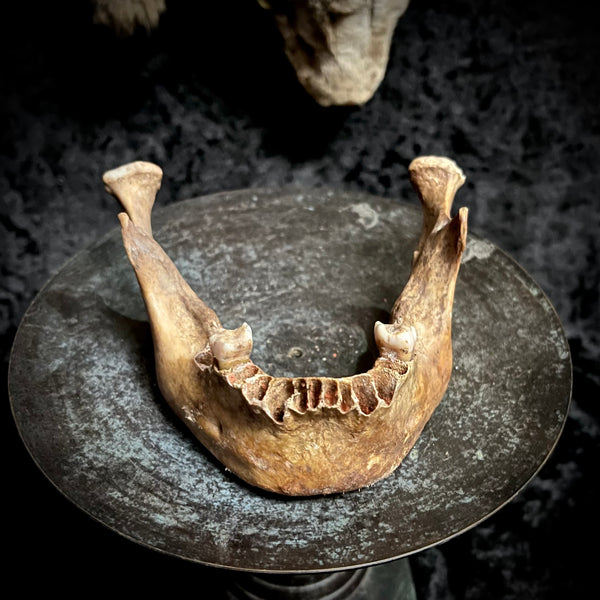 A mandible