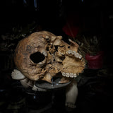 Human skull
