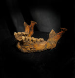 A mandible