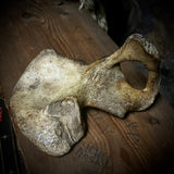 Human hip bone