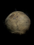 Human skull