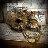 Human skull with mandible