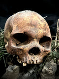 A human skull