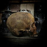 Human skull