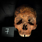 Item 7. Human skull