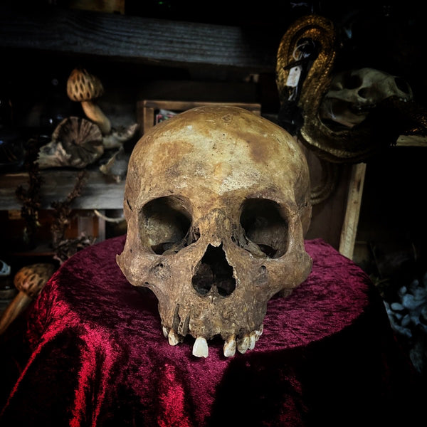 Human skull