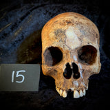 Item 15. Human skull