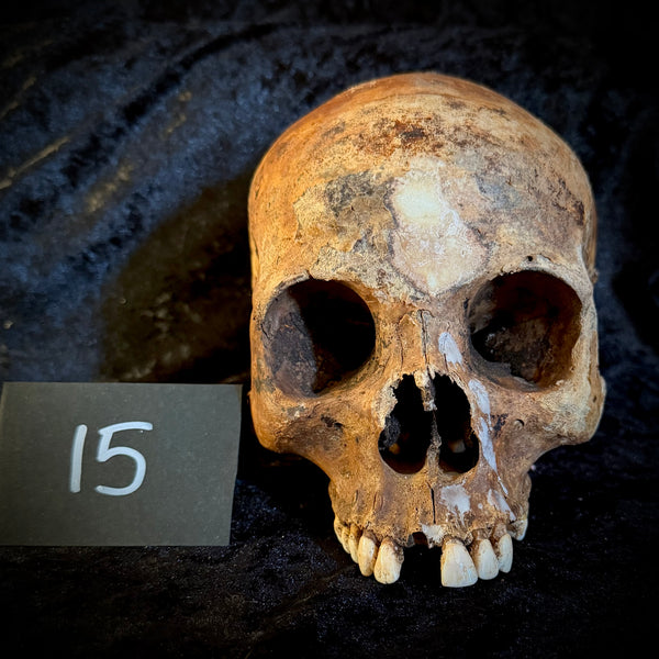 Item 15. Human skull