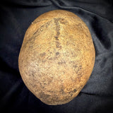 Item 9. Human skull cap