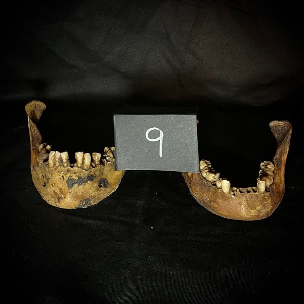 Item 9. Two human mandibles