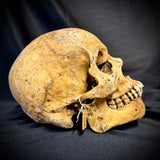 Item 1. Human skull with mandible