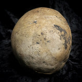 Human skull