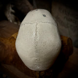Medically prepared human skull