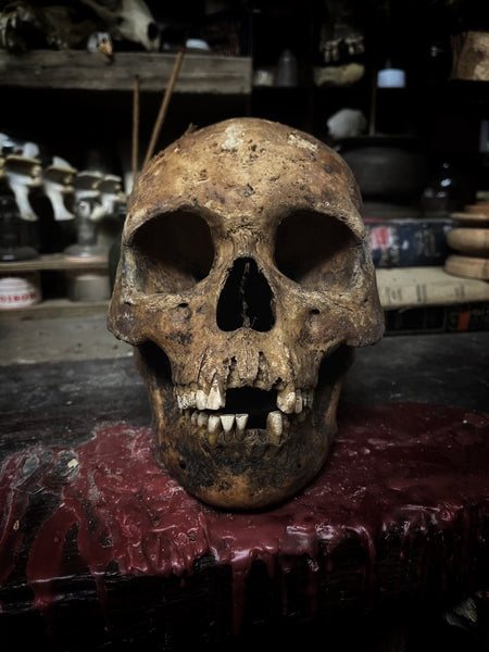 Human skull with mandible