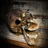 Human skull with mandible
