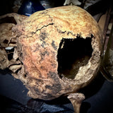 Human skull with bone cancer