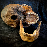 Item 4. Human skull with mandible