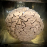 A human brain