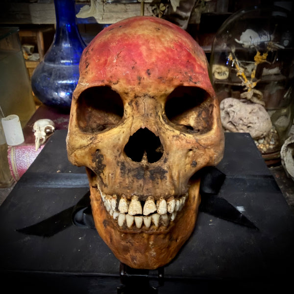 Human skull with mandible
