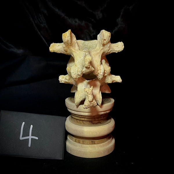 Item 4. Double human vertebrae stand