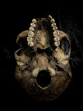 Human skull