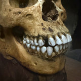 Human skull with mandible
