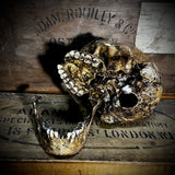 Human skull with mandible